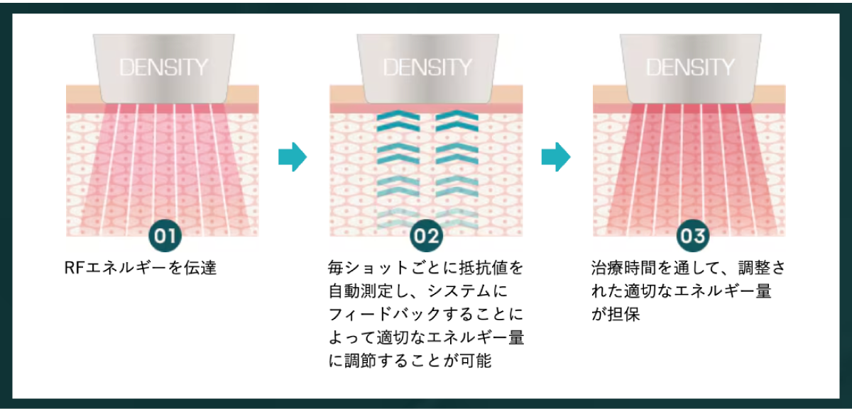 肌の状態を都度確認し、均一なエネルギーを照射<br />
