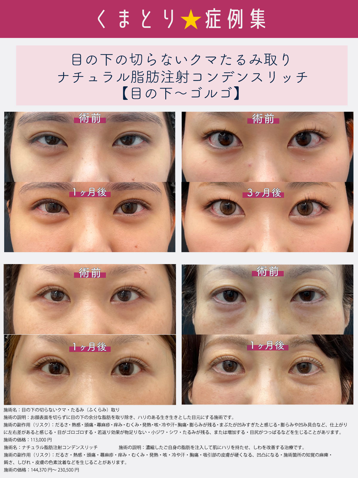 目元の印象で第一印象はグッと変わる！！佐藤圭之輔医師のクマ取り✨