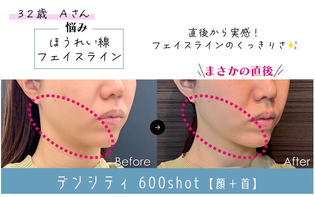 【実録】衝撃の効果実感！！