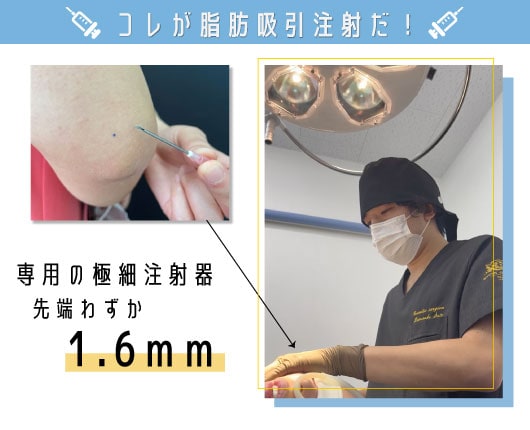 脂肪吸引注射ってどんな施術？
