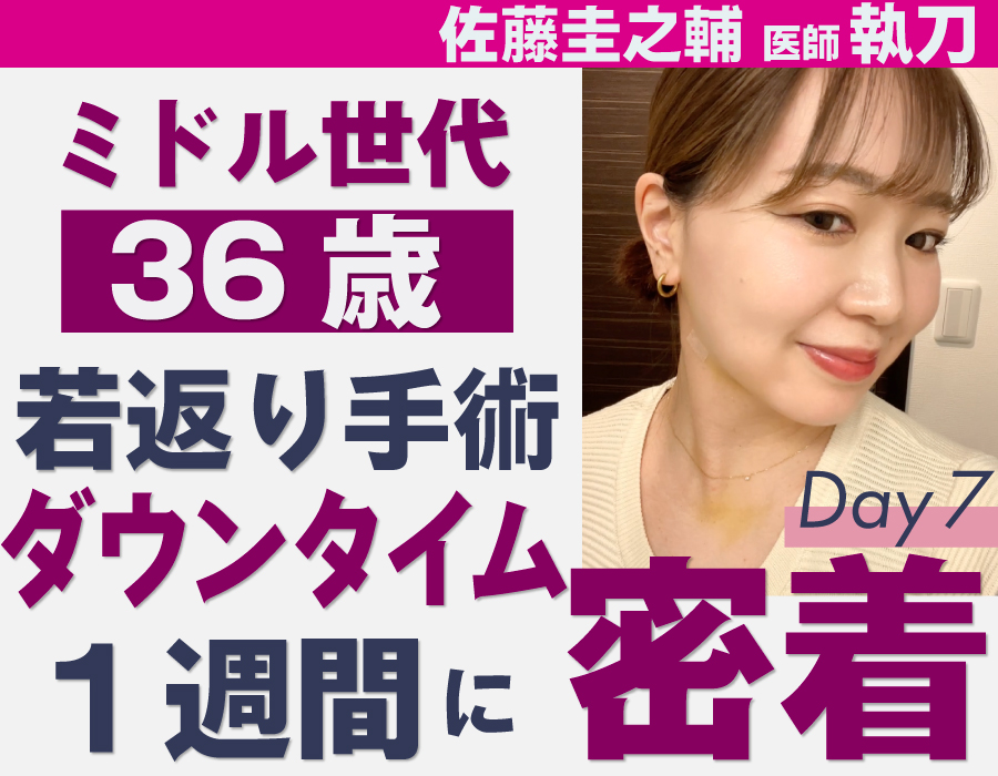 【ミドル世代】術後１週間でもこの完成度✨36歳の若返り整形《脂肪吸引＆糸リフト＆脂肪注入＆バッカルファット除去》【若返り×脂肪吸引といえば、東京,赤羽院佐藤圭之輔医師にお任せ】