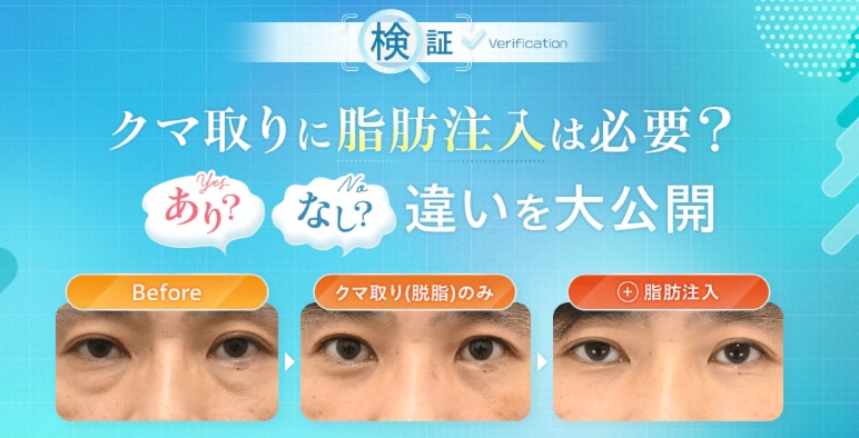 《検証》クマとりに「脂肪注入」は必要？〜ありorなしの違いを大公開〜