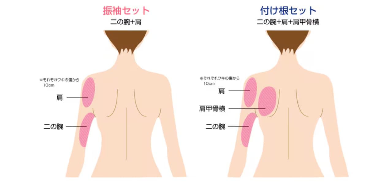 通常価格＆モニター価格・施術範囲の詳細はこちら！