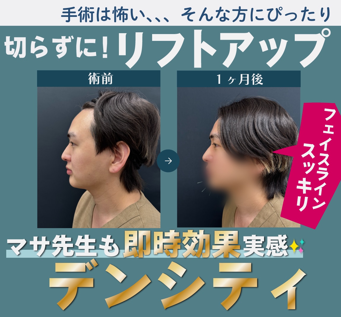 デンシティは痛い？効果はいつから？現役美容外科医《院長マサ先生》の“自腹”体験レポ＆症例公開！
