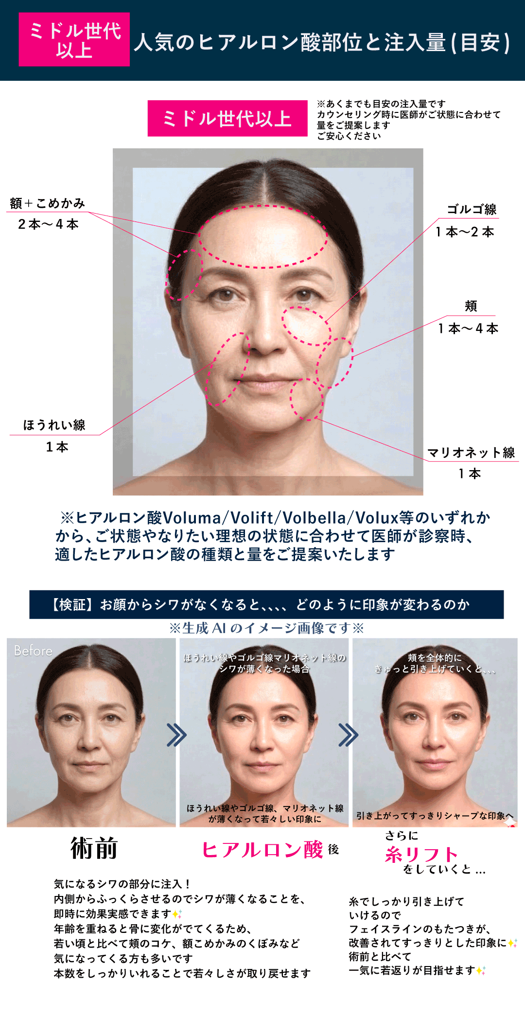 30代・40代の悩み：ほうれい線や気になるシワを手軽に改善