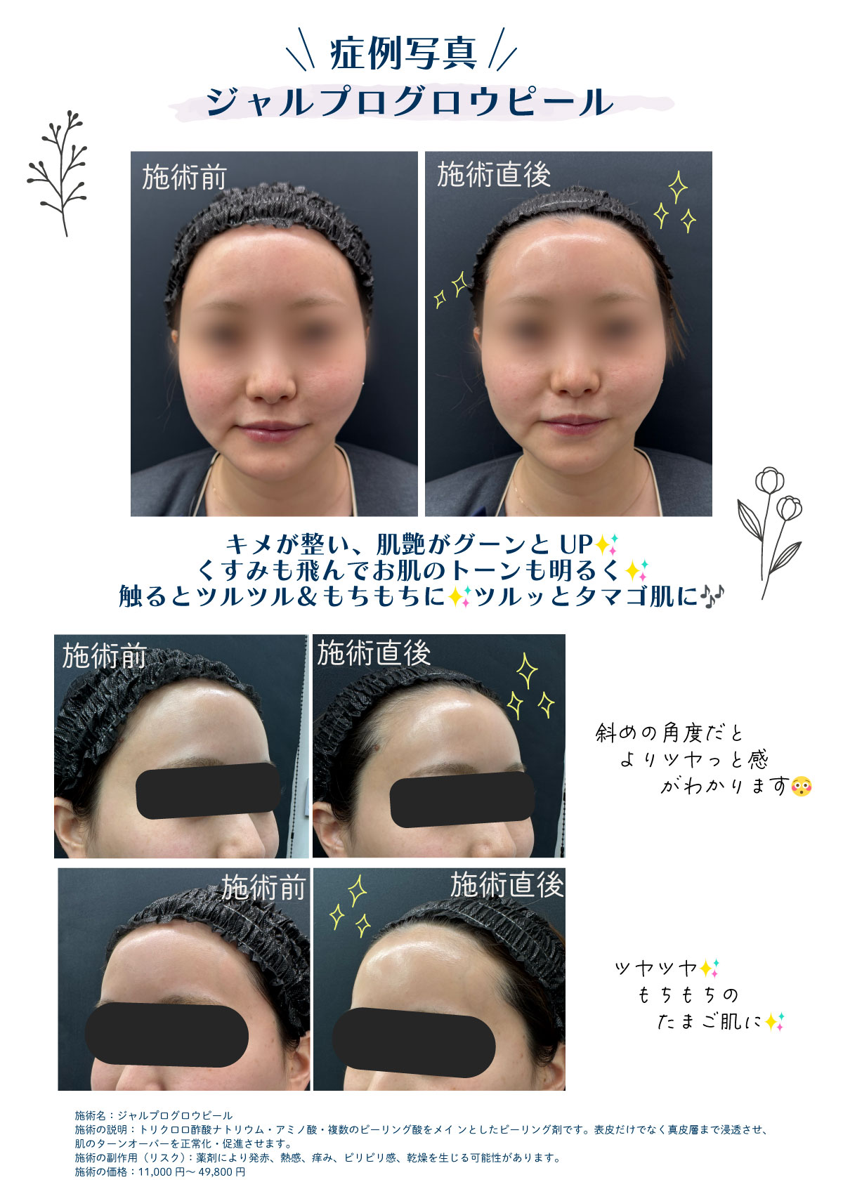 症例写真【直前／直後】