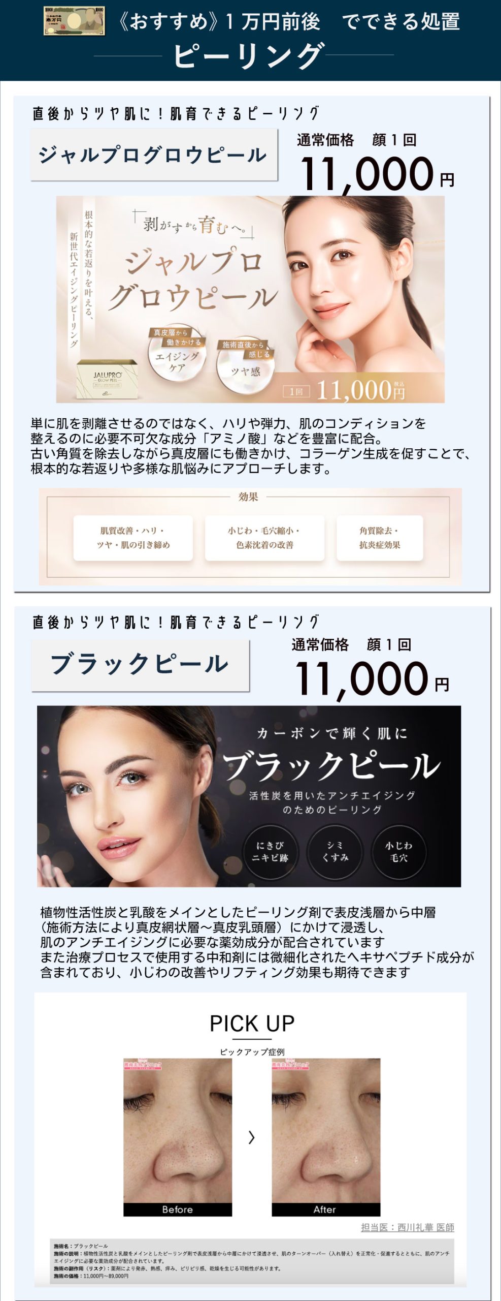 【毛穴／肌育／肌艶／ざらつき改善】ブラックピーリング・ジャルプログロウピール