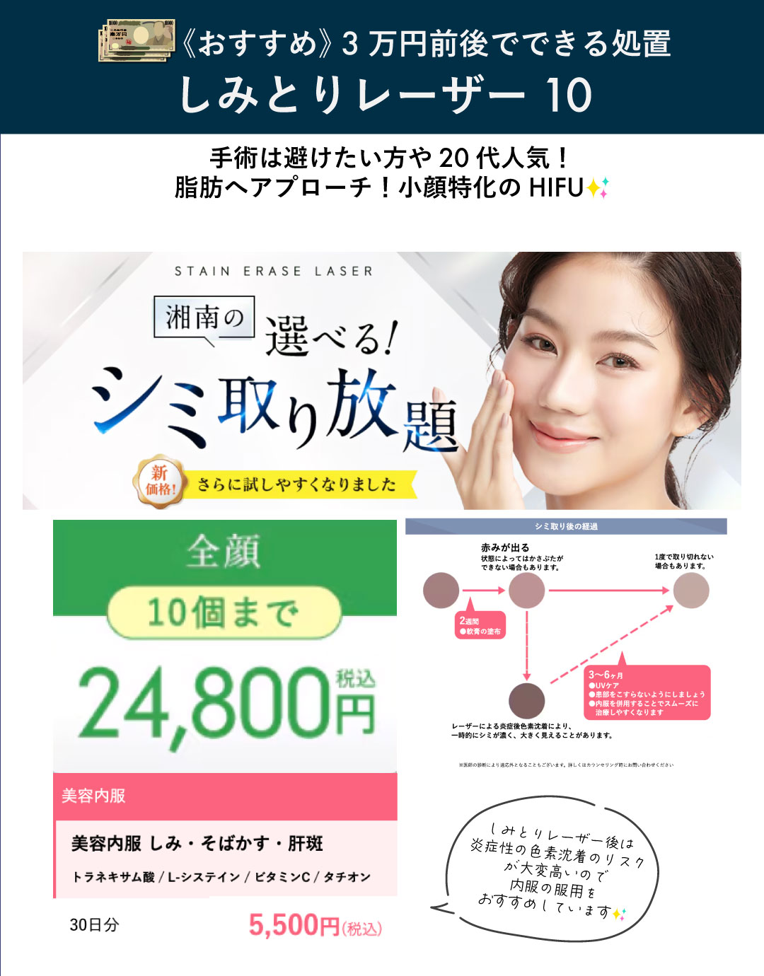 【しみ】しみとりレーザー10　※大きさ問わず10個まで（顔）