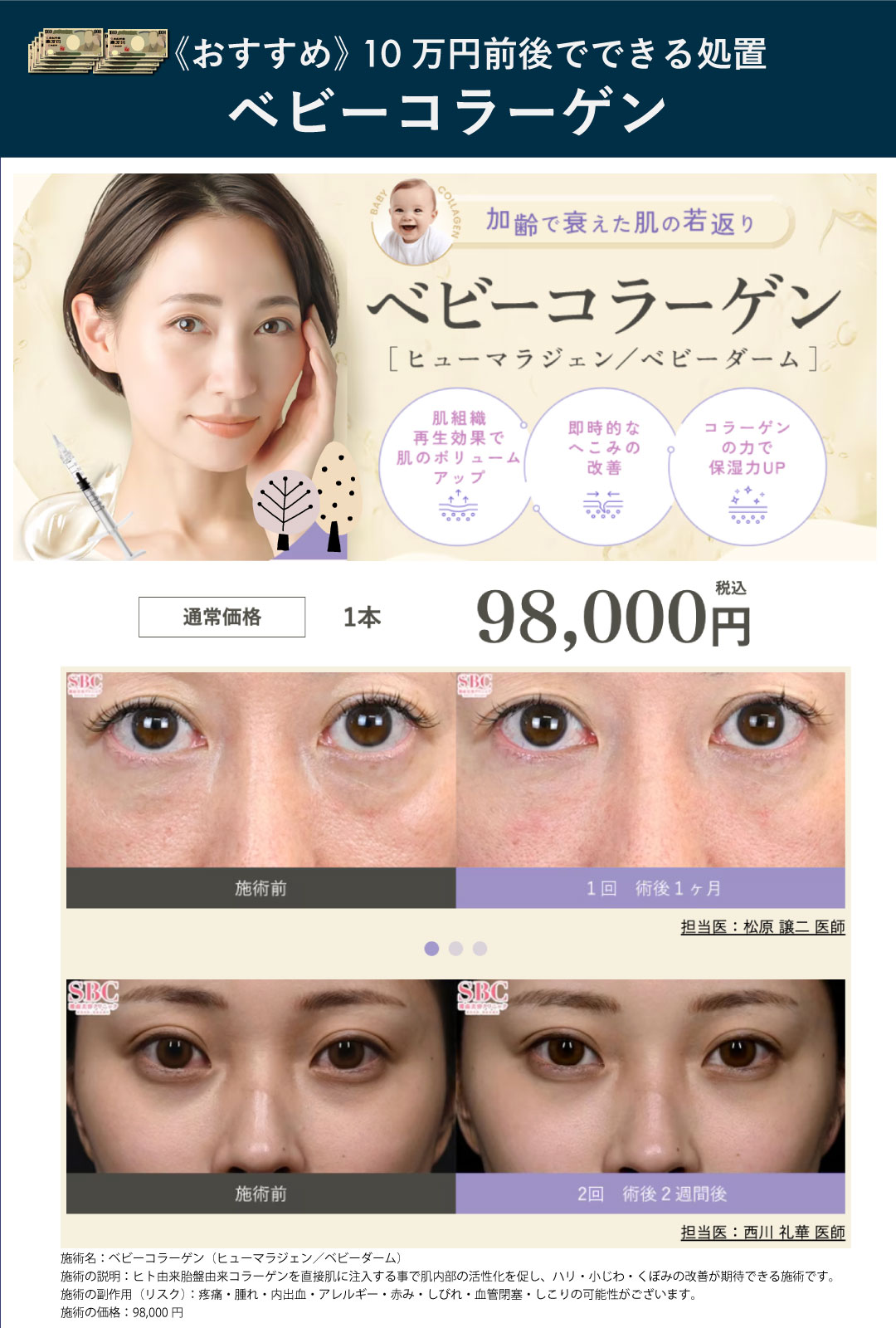 【目の下のクマ／肌のハリ】ベビーコラーゲン