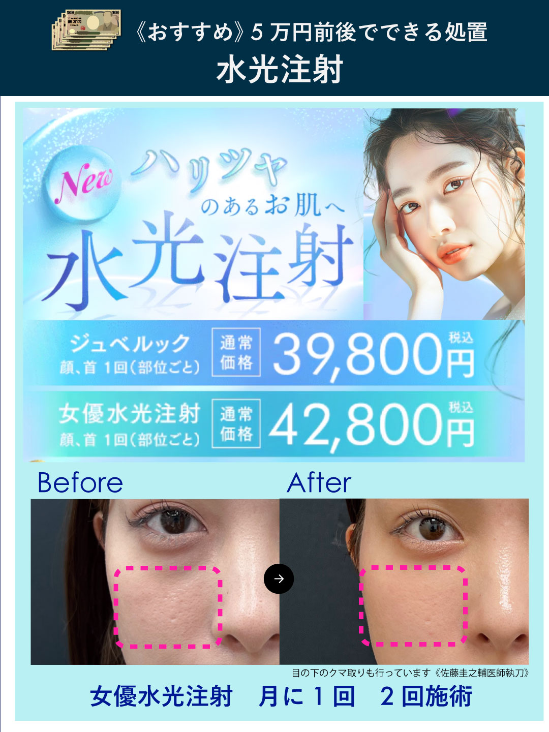 【ツヤ肌／肌育／肌質改善】水光注射