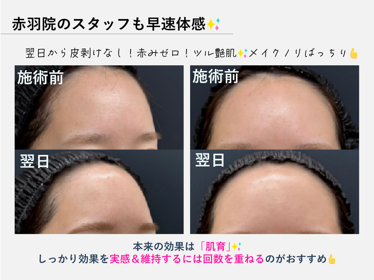 赤羽院スタッフが早速体感！