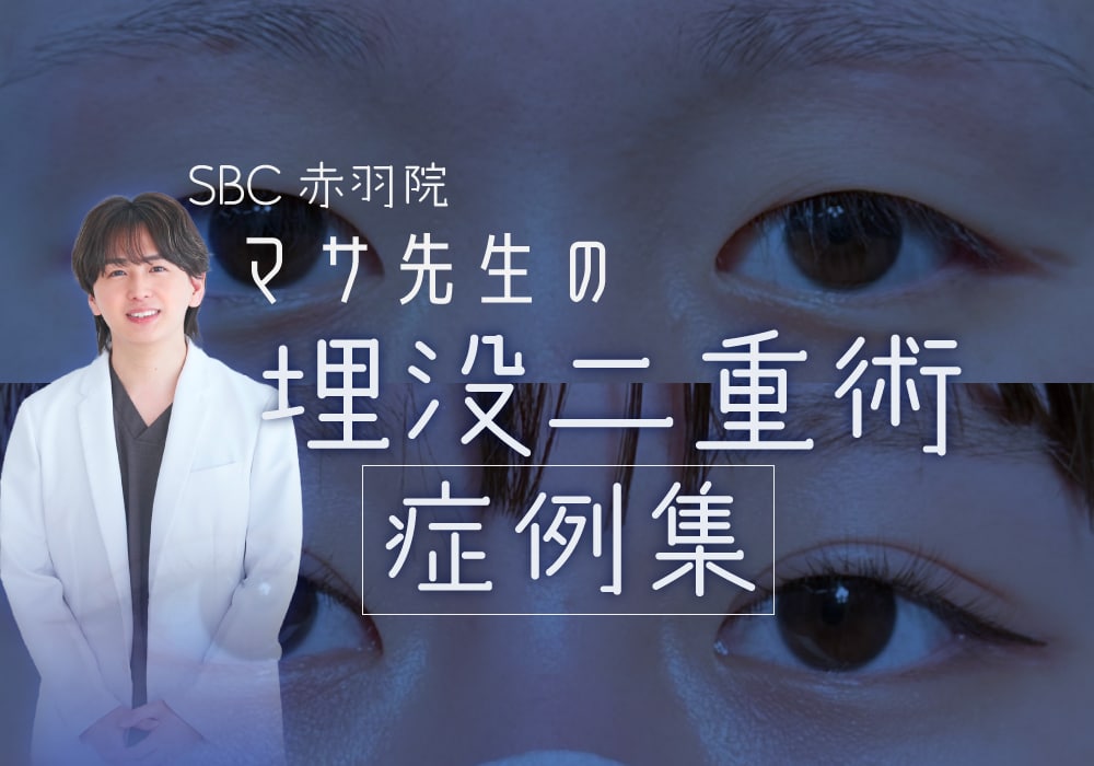【埋没二重術★症例集】末広・平行・Mixなど豊富な二重症例と、マサ先生の親身なデザイン力で理想の目元へ