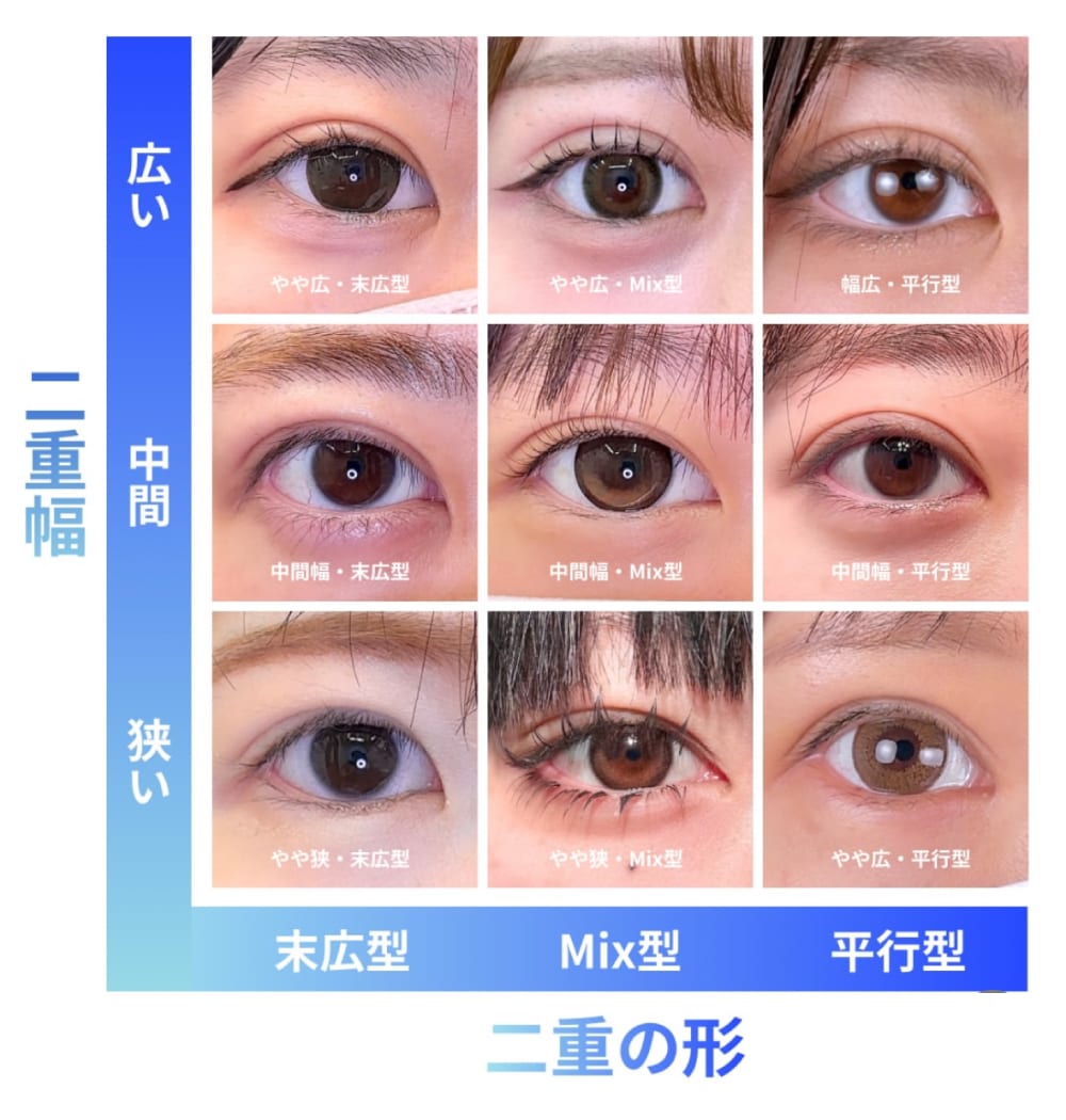 あなたの理想はどれ？　マサ先生の二重術✨