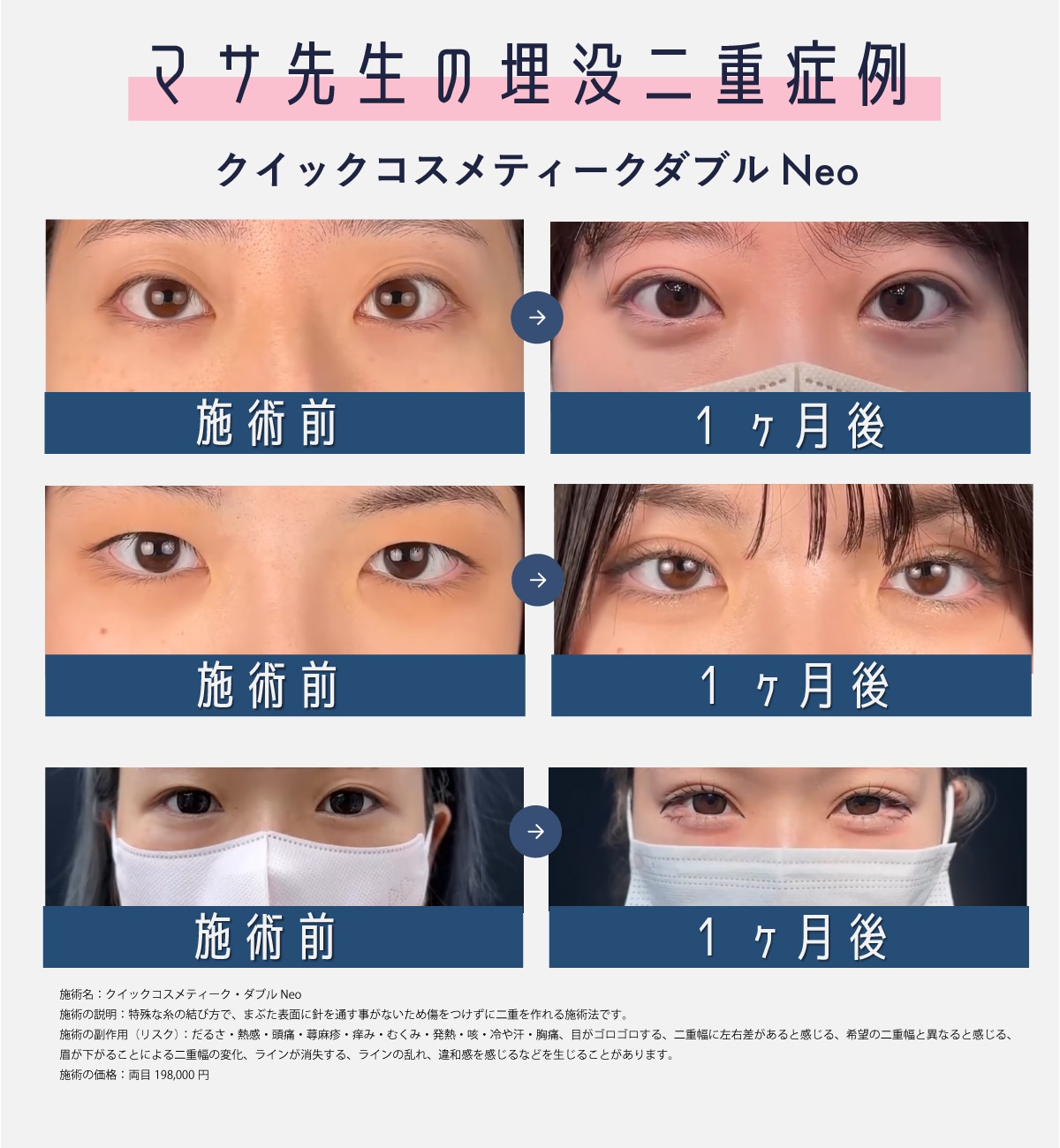 【平行型】華やかにパッチリな目元になりたい