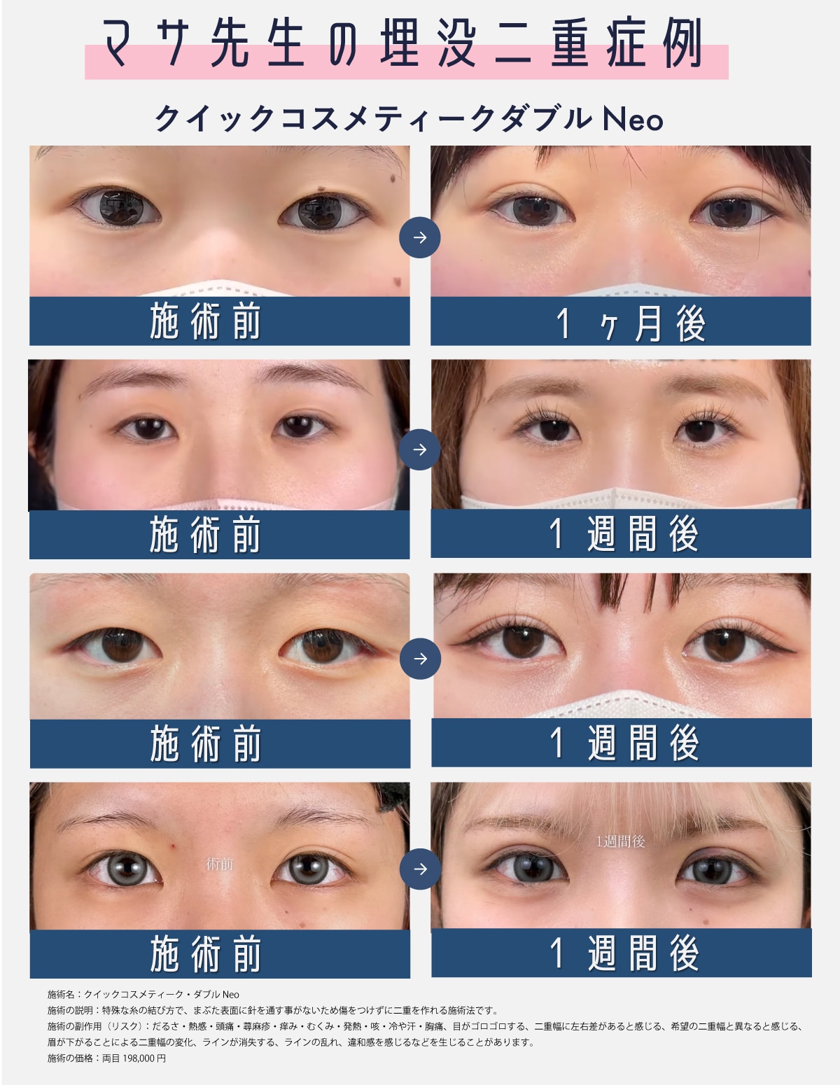 【症例】末広型　ナチュラルに✨