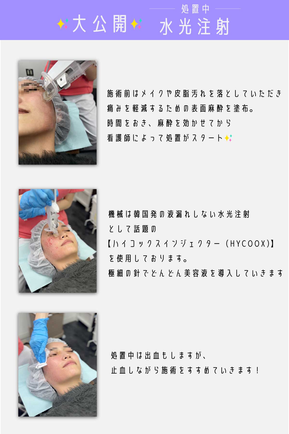 女優水光注射はこのように行われています✨☝️