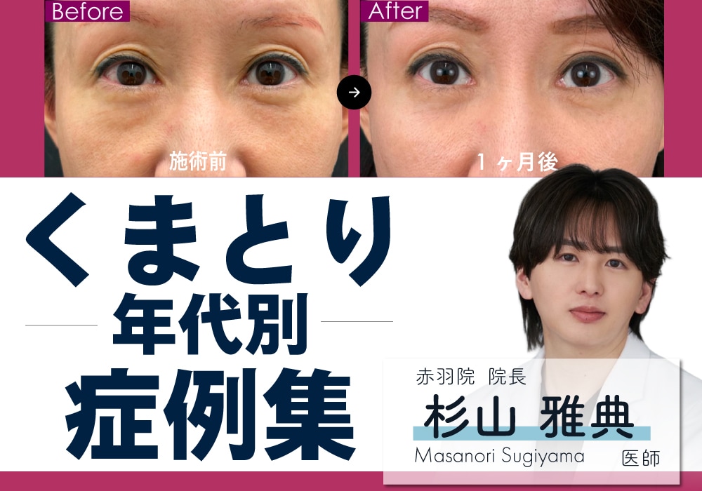 《必見》大人気のマサ先生の目の下のクマ取り症例集