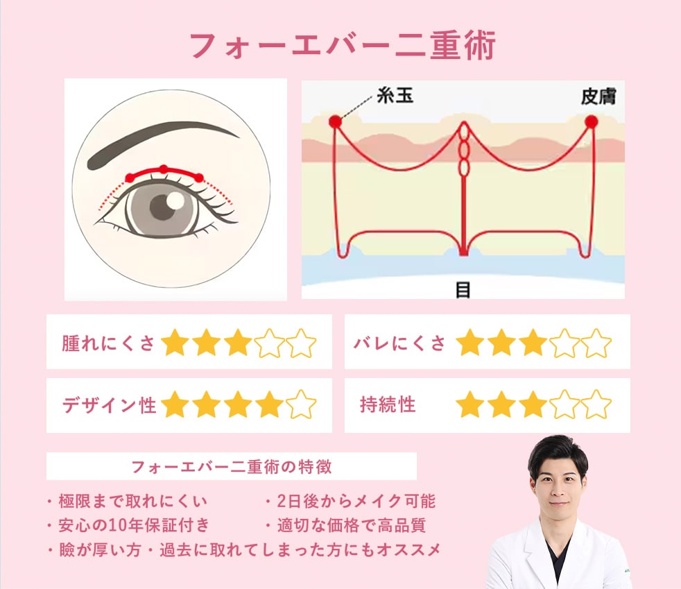 フォーエバー二重術