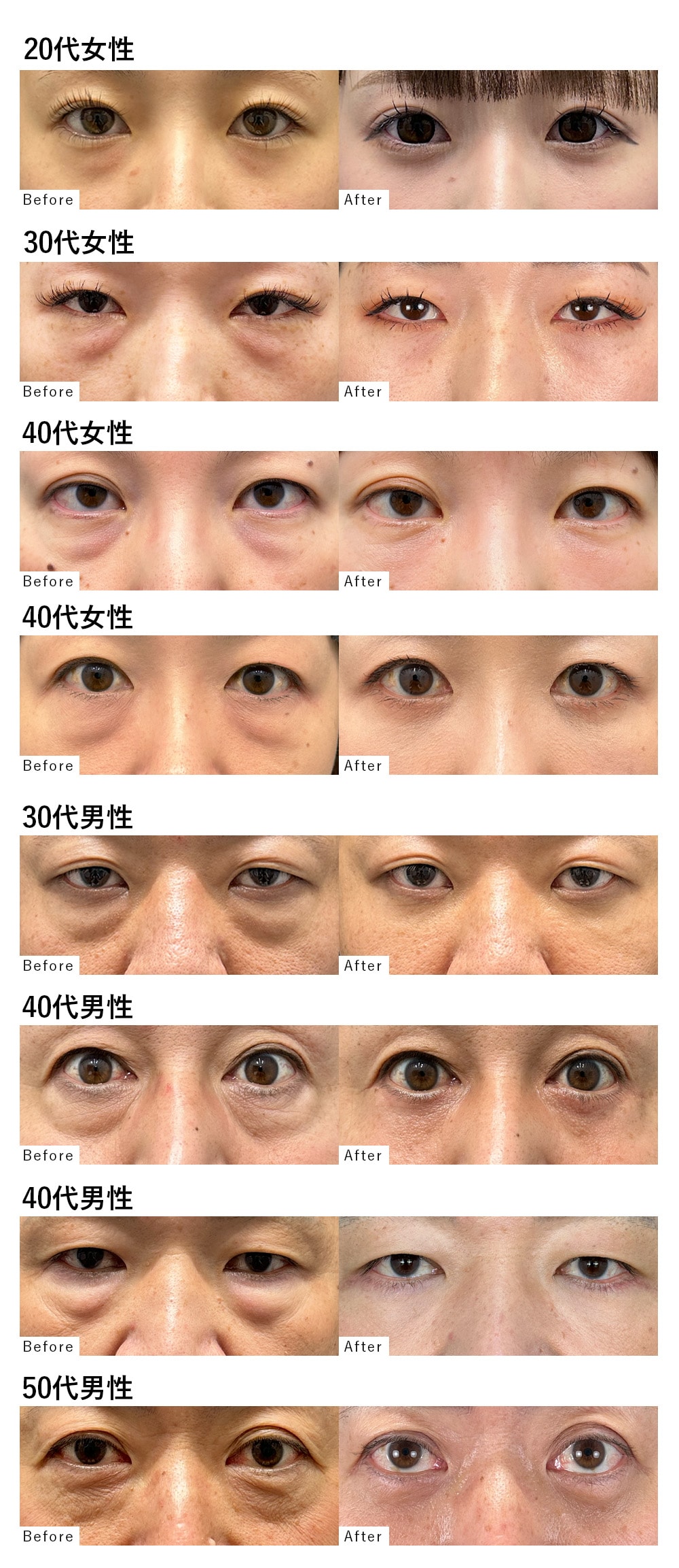 年代別クマ取り