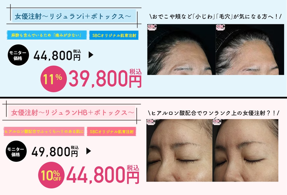 今なら女優注射が期間限定価格で受けられる！