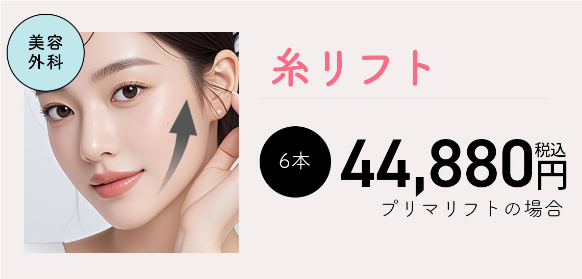 糸リフト