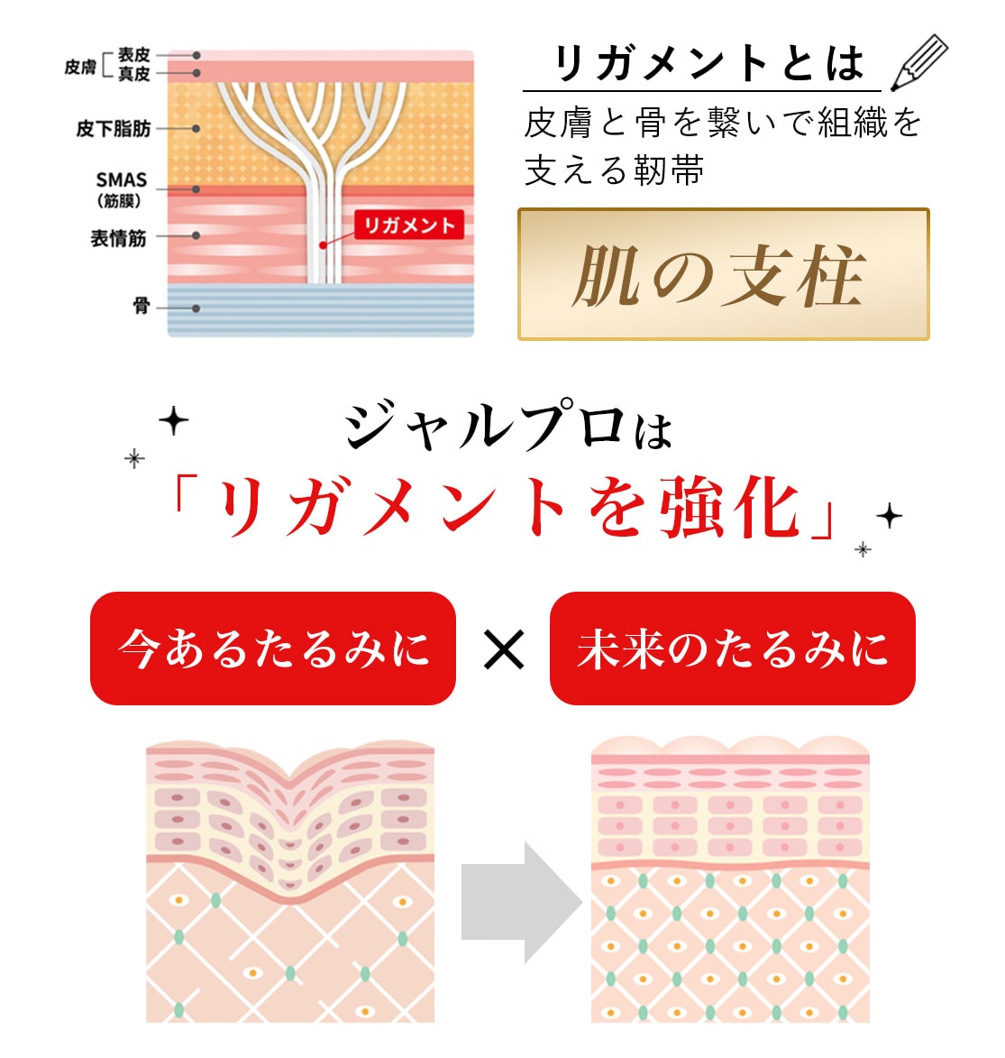 リガメントとは