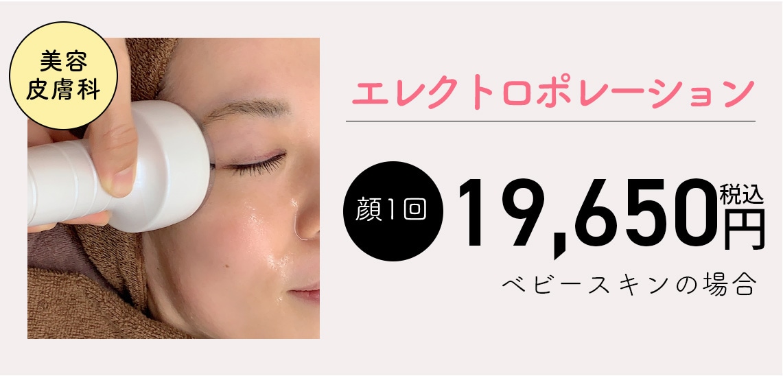 エレクトロポレーション