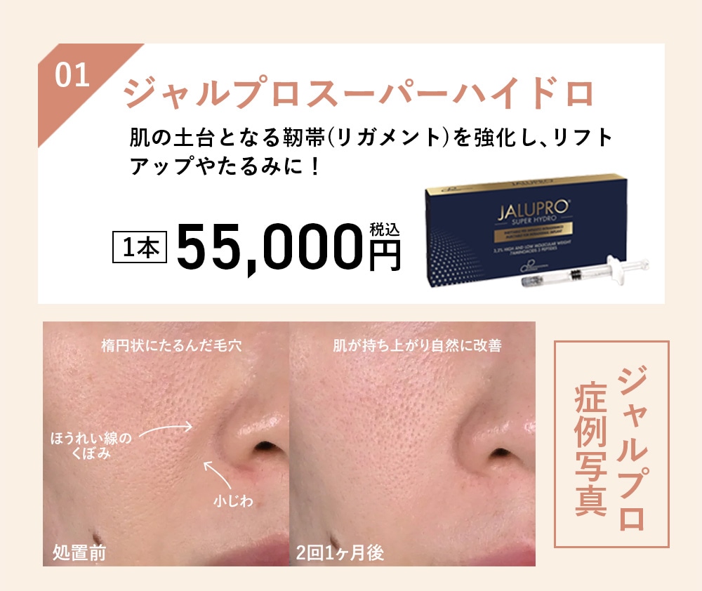 ジャルプロスーパーハイドロ