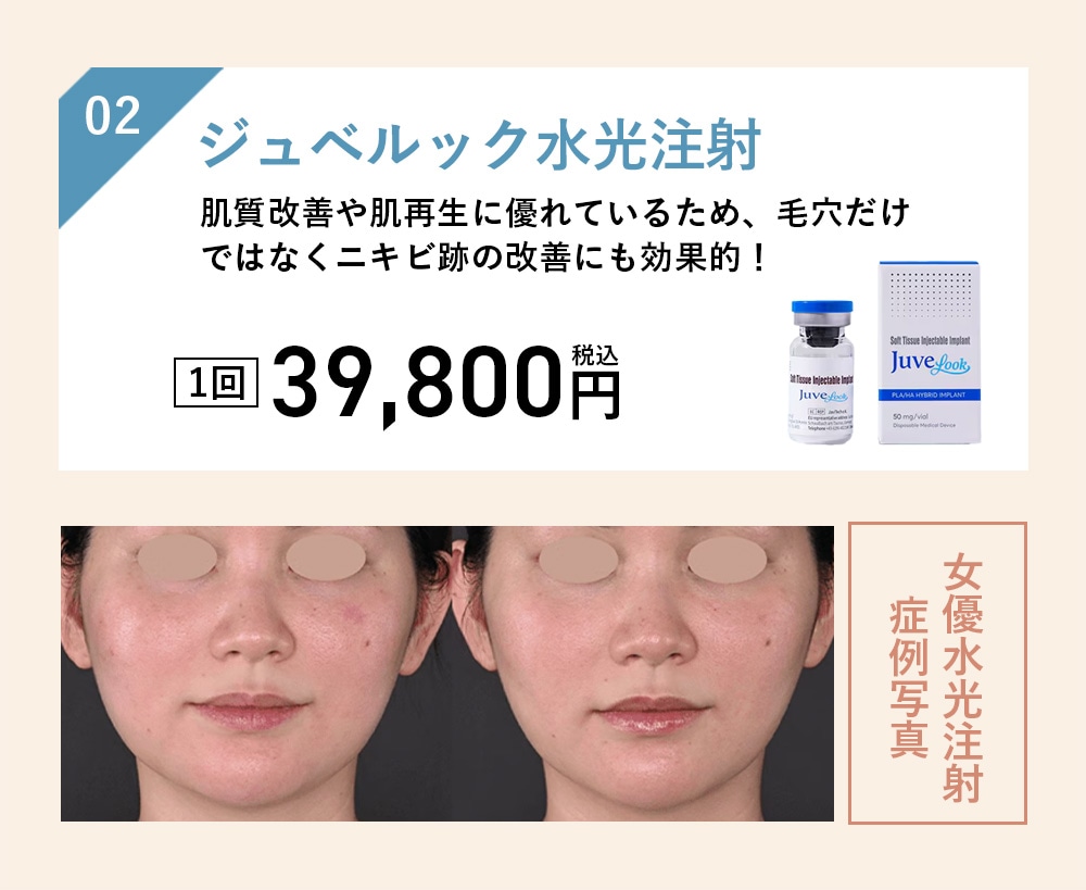 ジュベルック水光注射