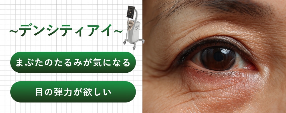 デンシティアイ