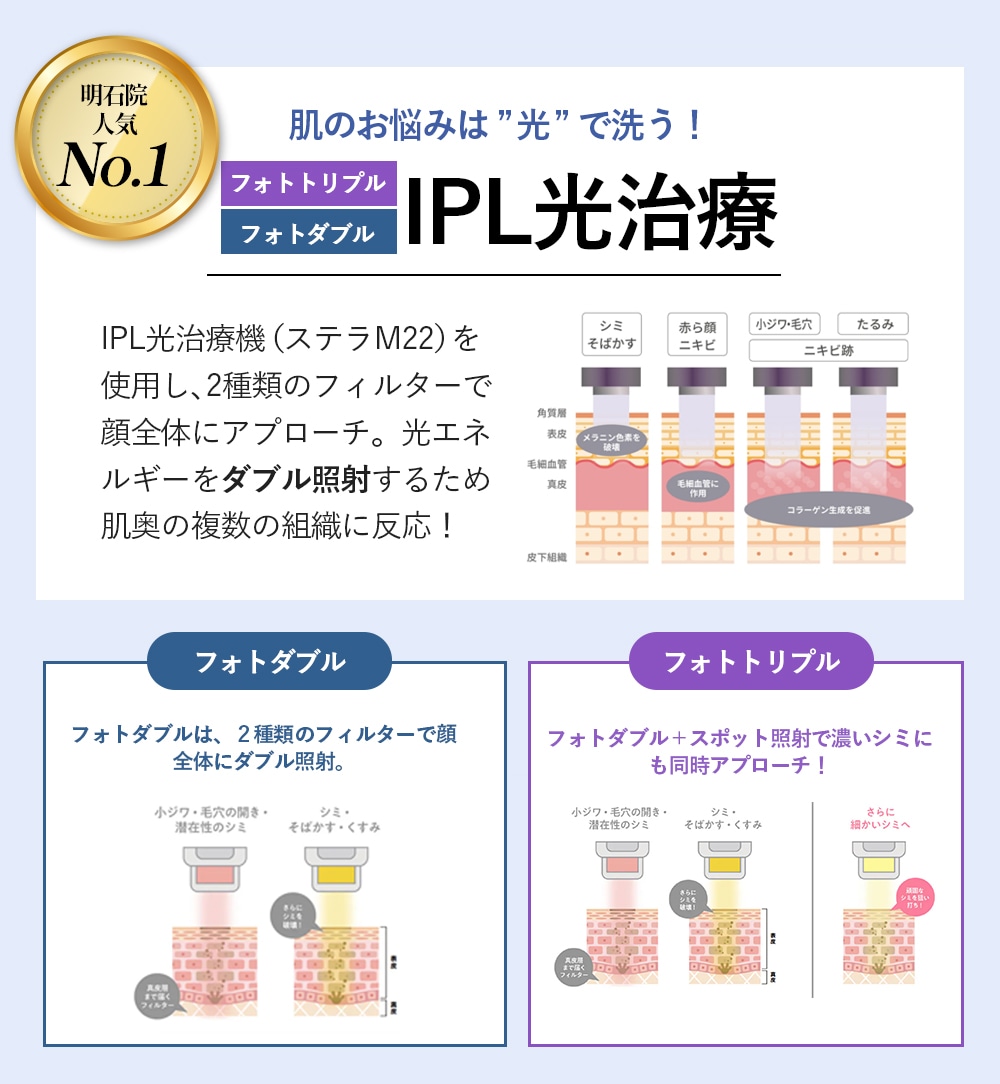 IPL光治療：フォトフェイシャル