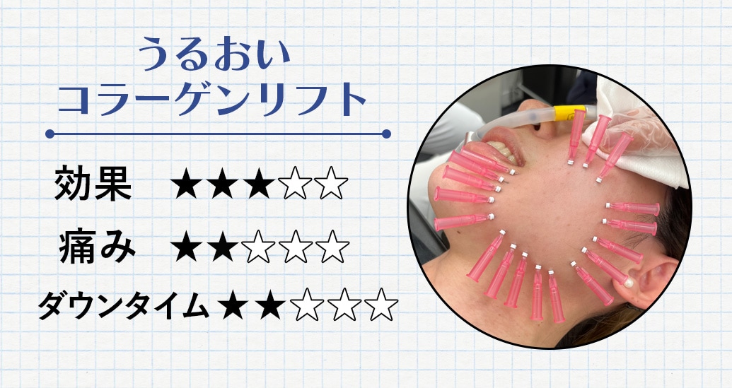 うるおいコラーゲンリフト