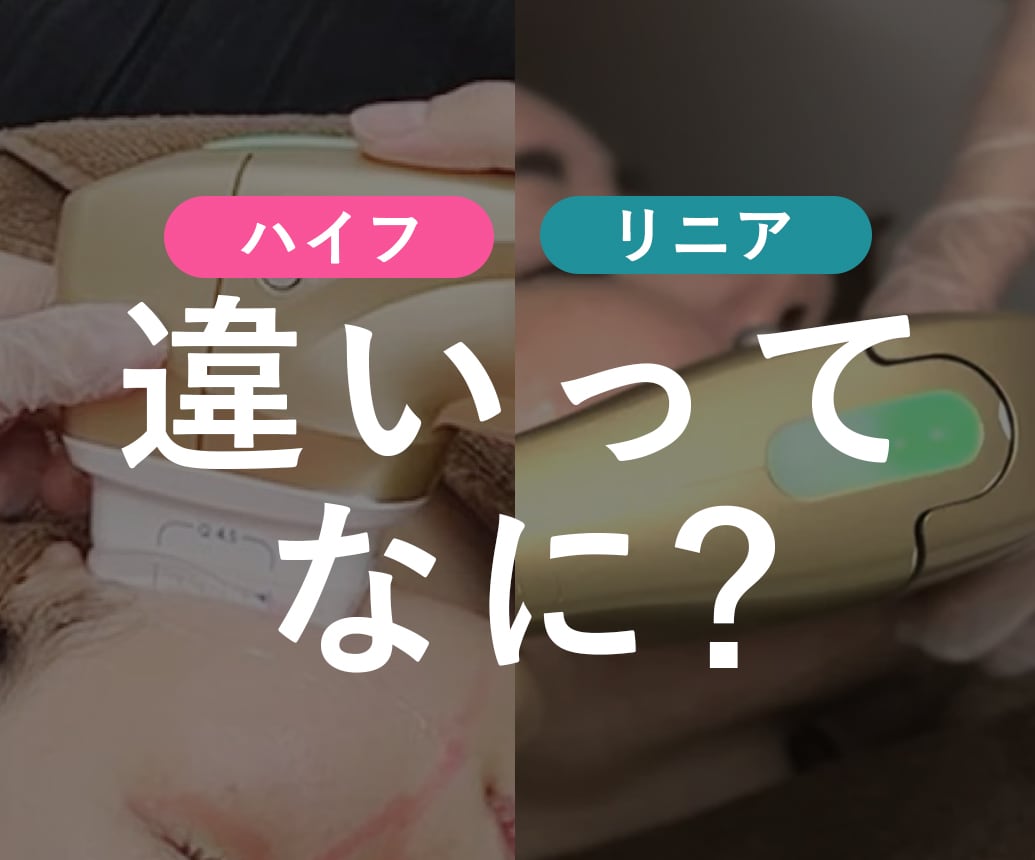 【たるみ&脂肪溶解】新・脂肪溶解リニアハイフ＋ウルトラプラスHIFUでスッキリフェイスラインに✨