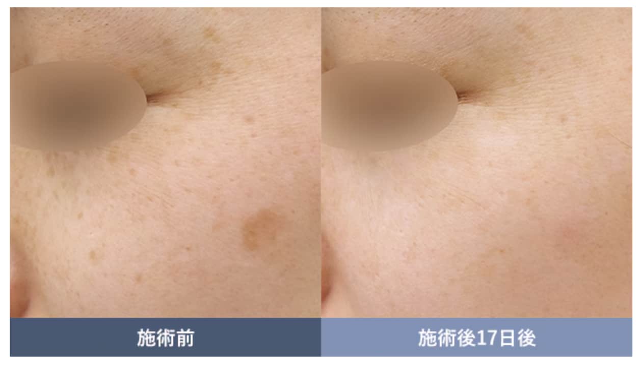 圧倒的冬がオススメ⛄️