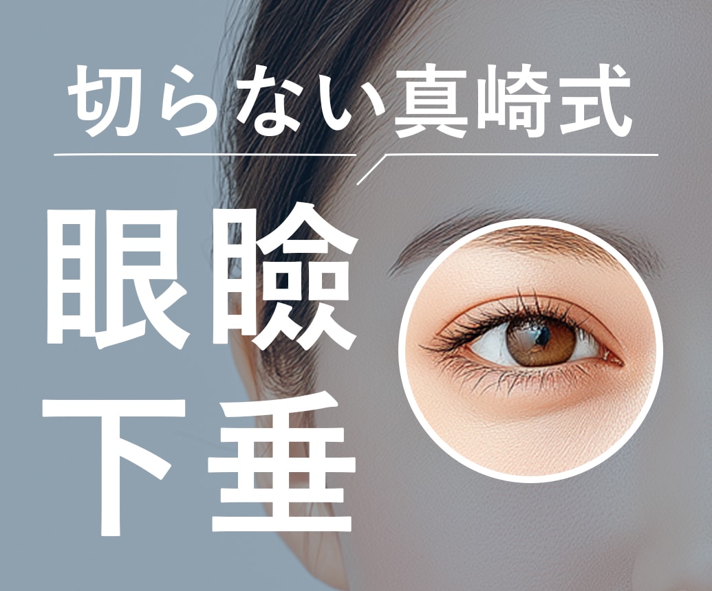 切らずに目の開きを改善！切らない眼瞼下垂とは？徹底解説｜湘南美容クリニック明石院