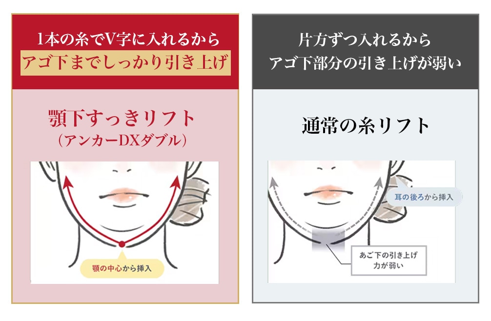 手軽にできて大きな変化