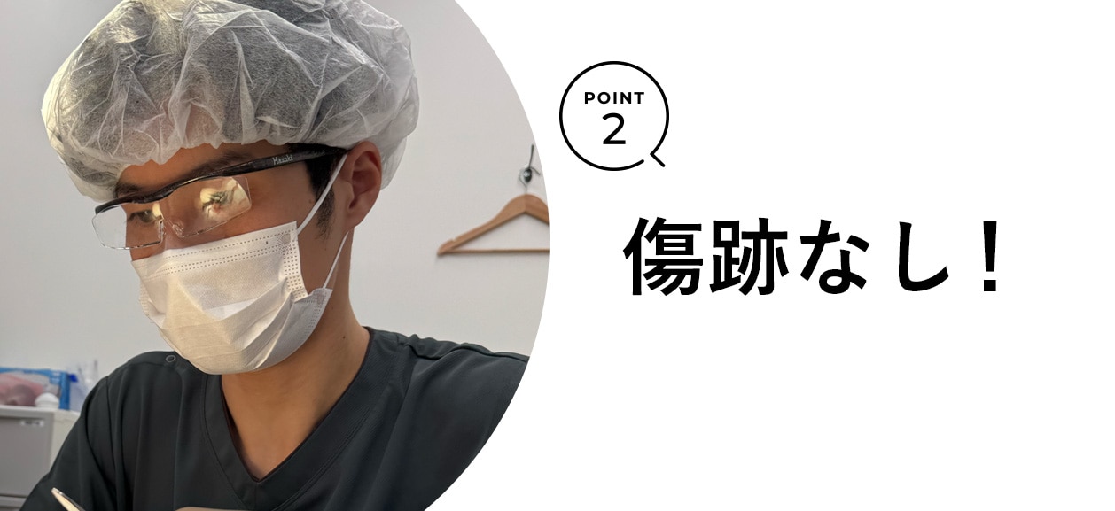 Point.02 傷跡なし！