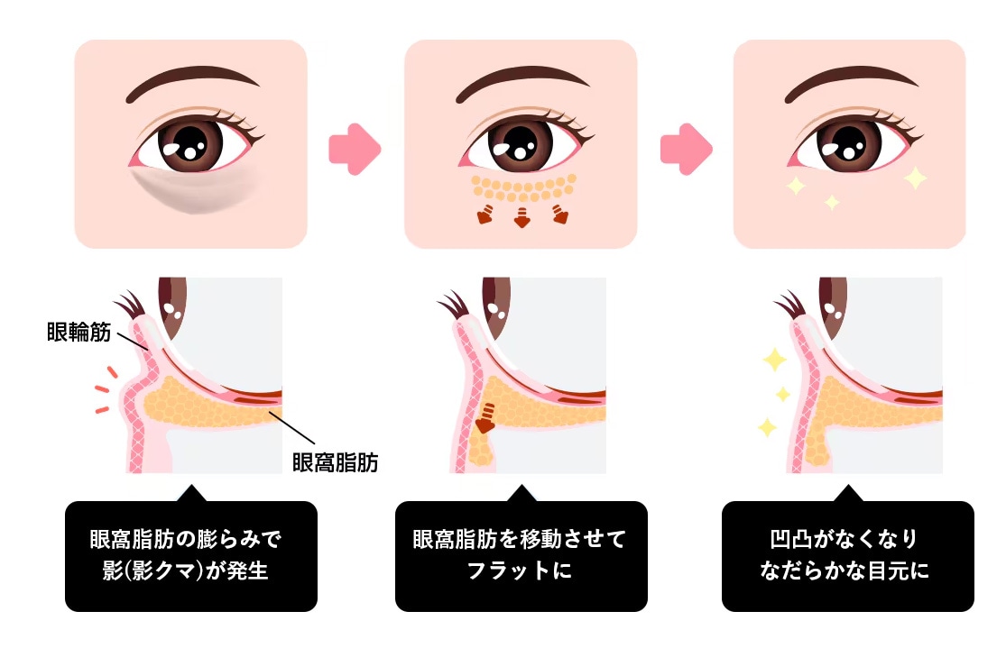 脂肪をとらずに動かす！