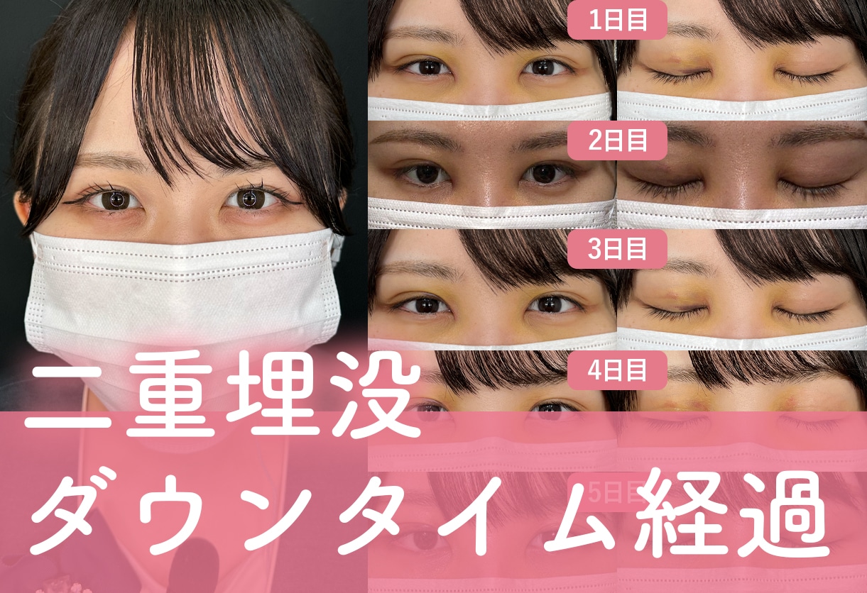 気になるダウンタイム