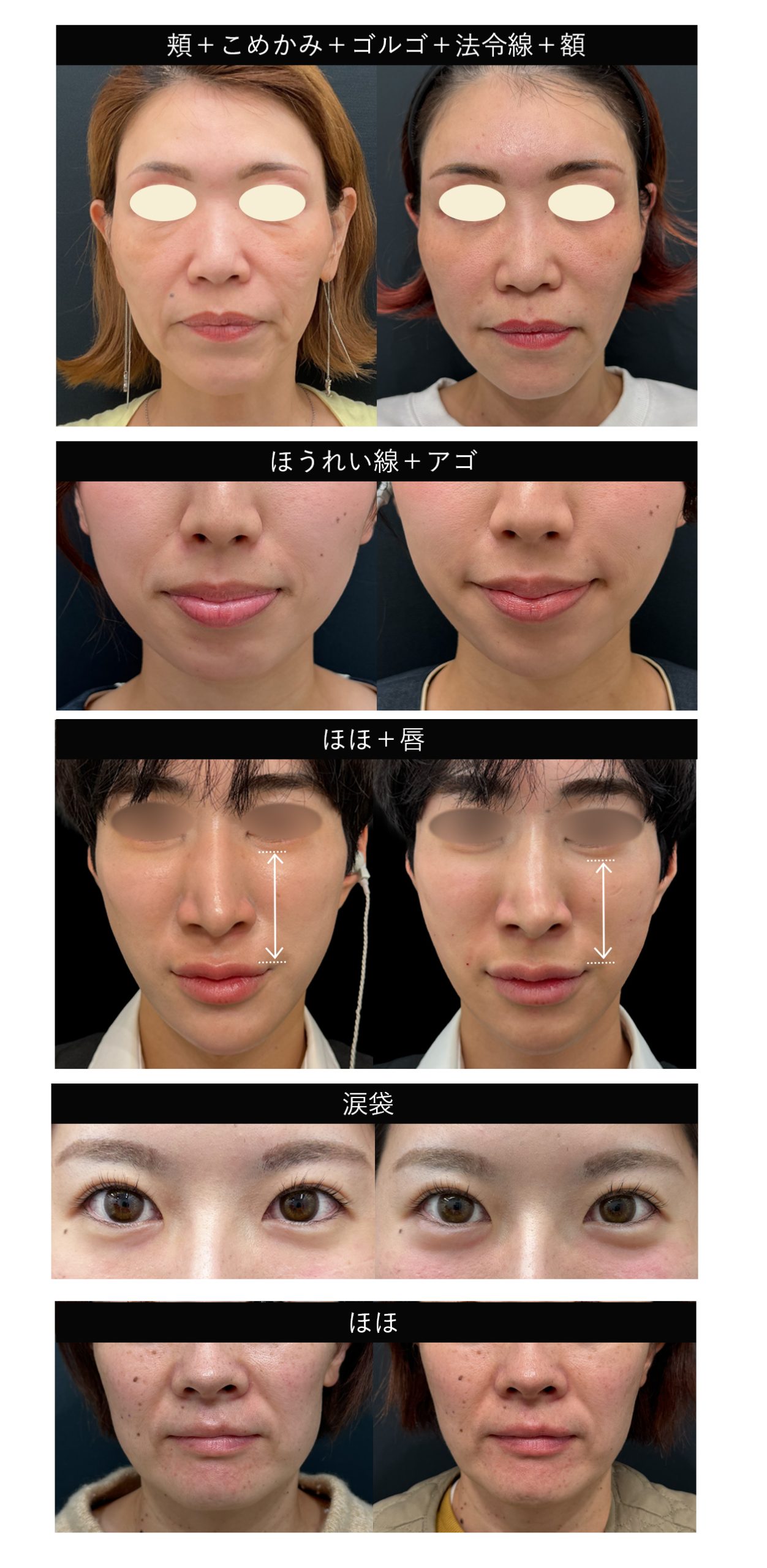 お顔立ちに合わせたオーダーメイド💉