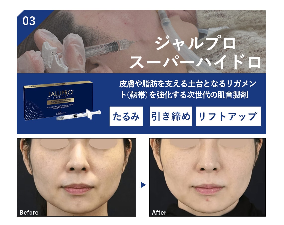 03.ジャルプロスーパーハイドロ