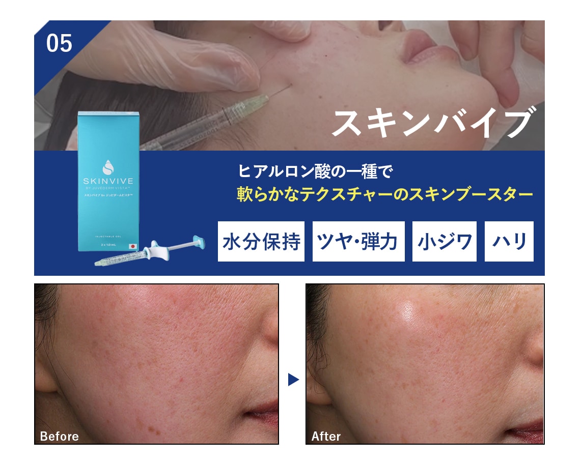 05.スキンバイブ