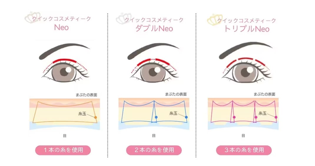 「シングル」「ダブル」「トリプル」の３パターン