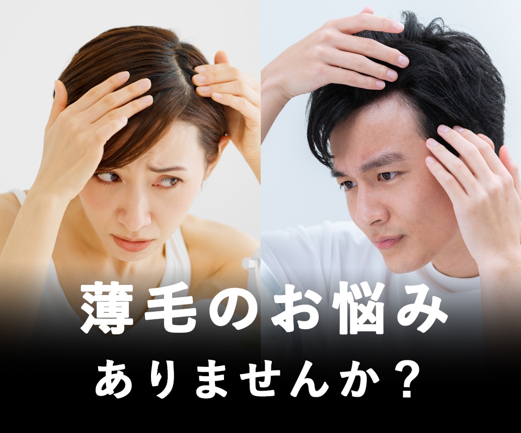 【AGA治療・薄毛治療】明石・神戸エリアで治療するなら湘南美容クリニック明石院