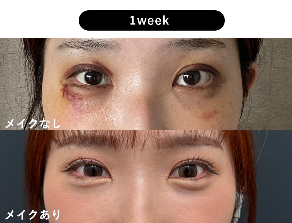 1week