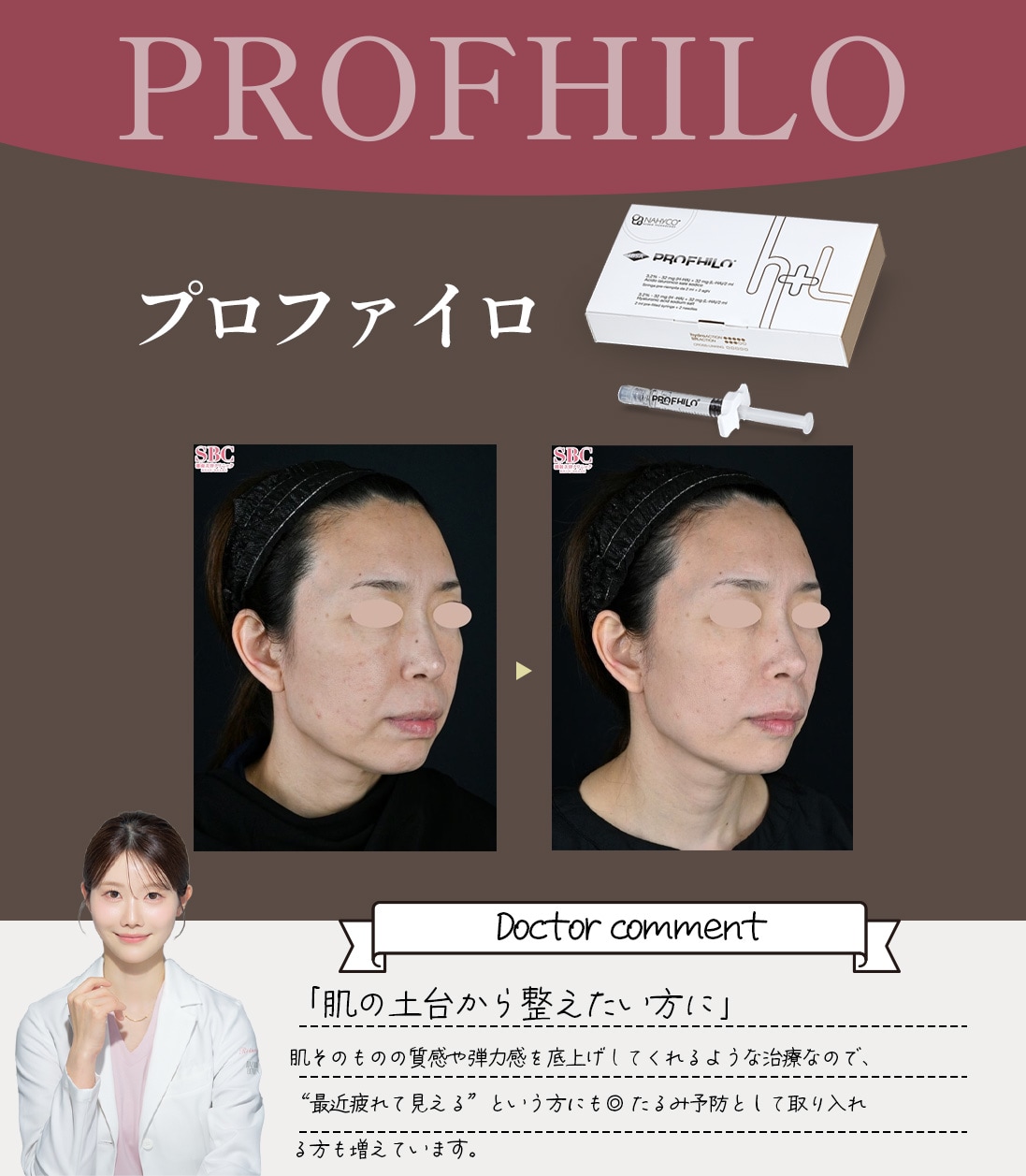 プロファイロ<br />
