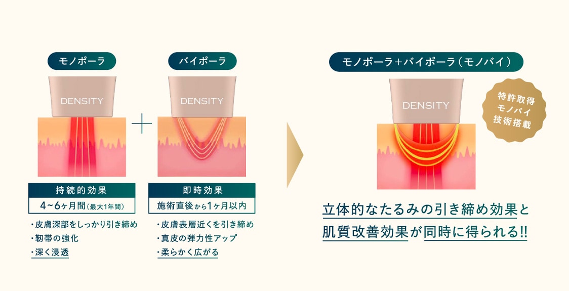 高周波（RF）で肌のハリ・引き締めを目指す治療