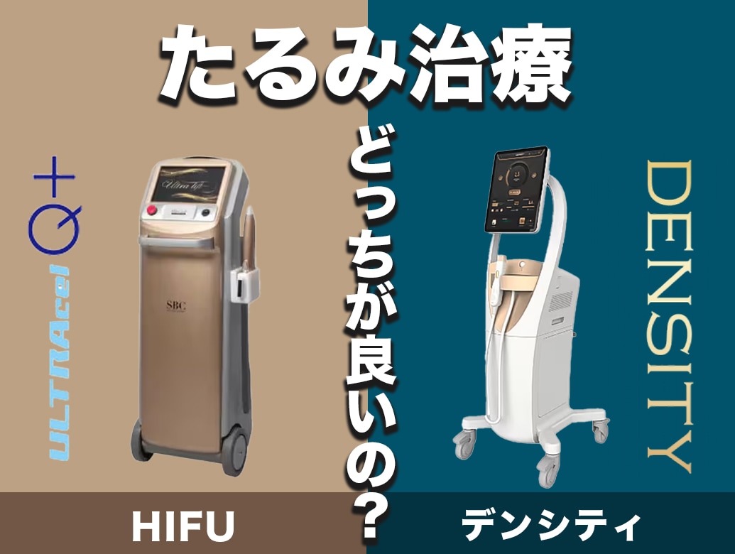 【神戸・明石・加古川」明石でハイフとデンシティならどっちがおすすめ？効果・違いを症例写真付きで徹底比較