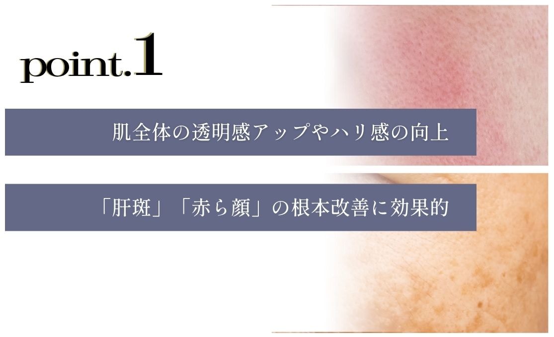 Point.1 治療の難しい「肝斑」「赤ら顔」の根本改善に効果的