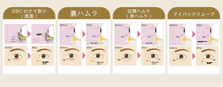 適応診断のミスマッチ